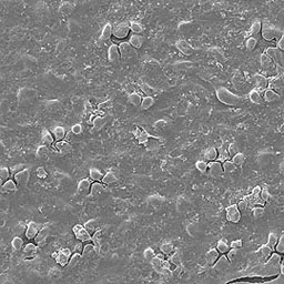 Fossil Ginkgo leaf magnified to show pores