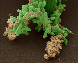 Iron-breathing microbes, Geobacter