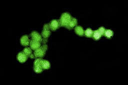 Pollution-breathing microbes, Dehalobium chlorocoercia