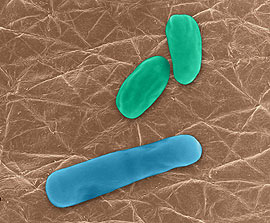 Anthrax, Bacillus anthracis