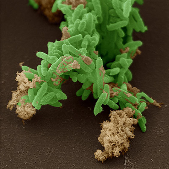 Iron-breathing microbes, Geobacter