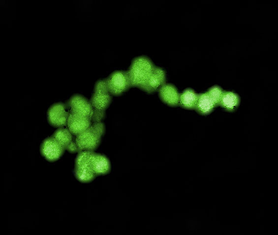 Pollution-breathing microbes, Dehalobium chlorocoercia