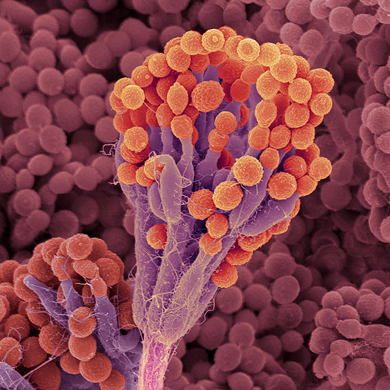 Antibiotic mold, Penicillium notatum