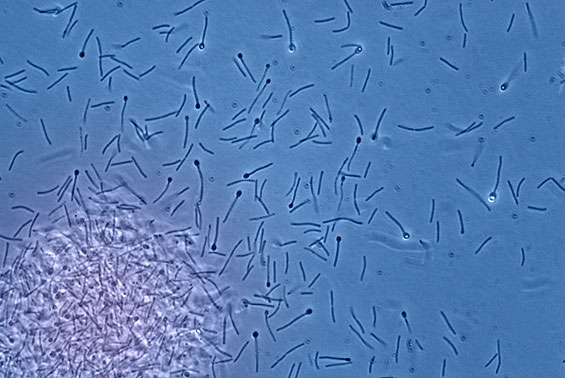Biofuel microbe, Clostridium phytofermentans