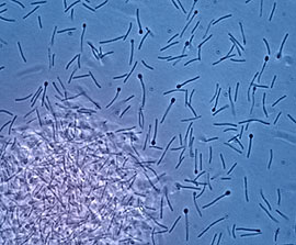 Biofuel microbe, Clostridium phytofermentans