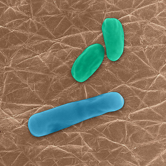 Anthrax, Bacillus anthracis